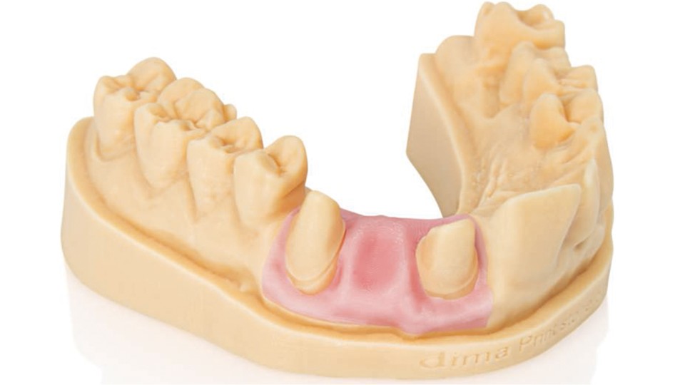 dima Print Gingiva Mask 3D gingiva resin