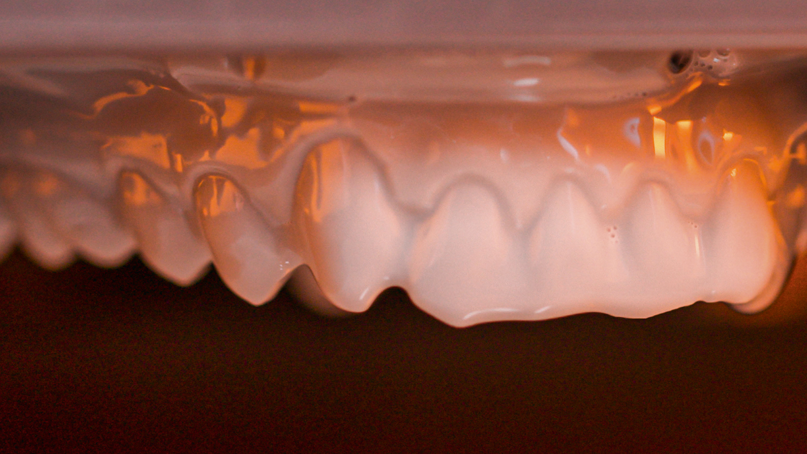 cara Print 4.0 – 3D printer for dental appliances
