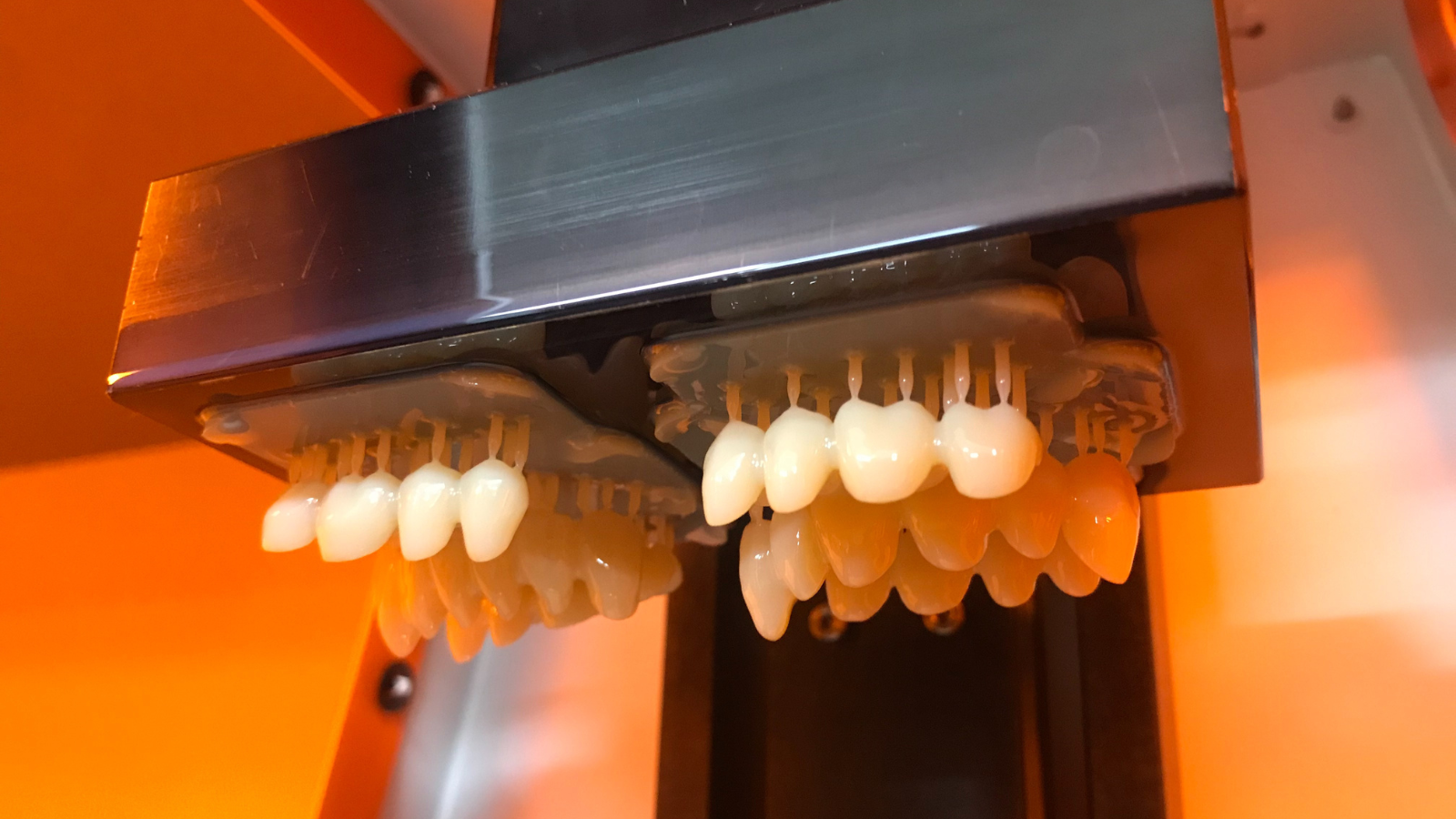 dima Print Digital Denture – Resin for 3D printed dentures